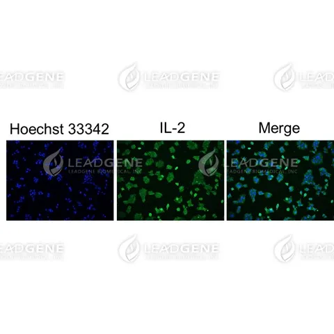 Anti-IL-2 Antibody [Clone 62-2]