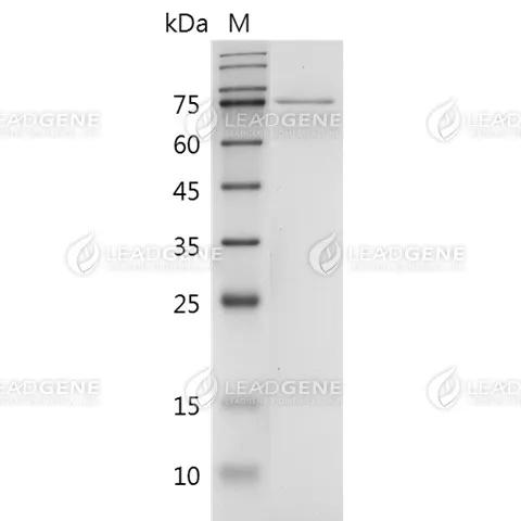 Human NF-L, His-SUMO Tag, E. coli