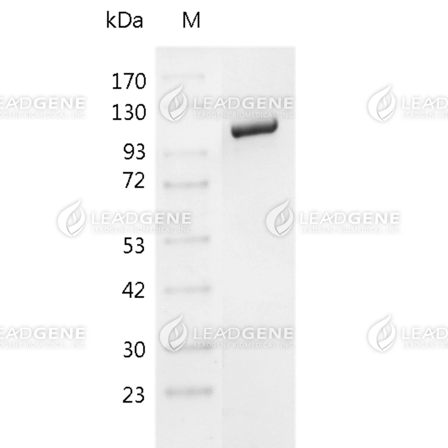 T7 RNA Polymerase