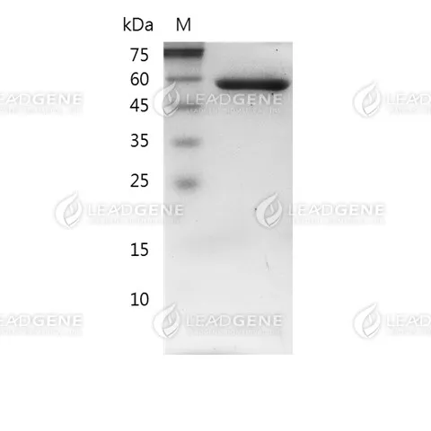 C. difficile Toxin B Protein, His tag, E. coli
