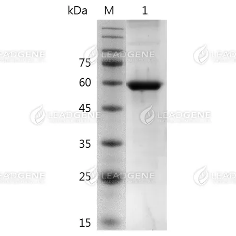 NiV Nucleocapsid Protein, His tag, E. coli