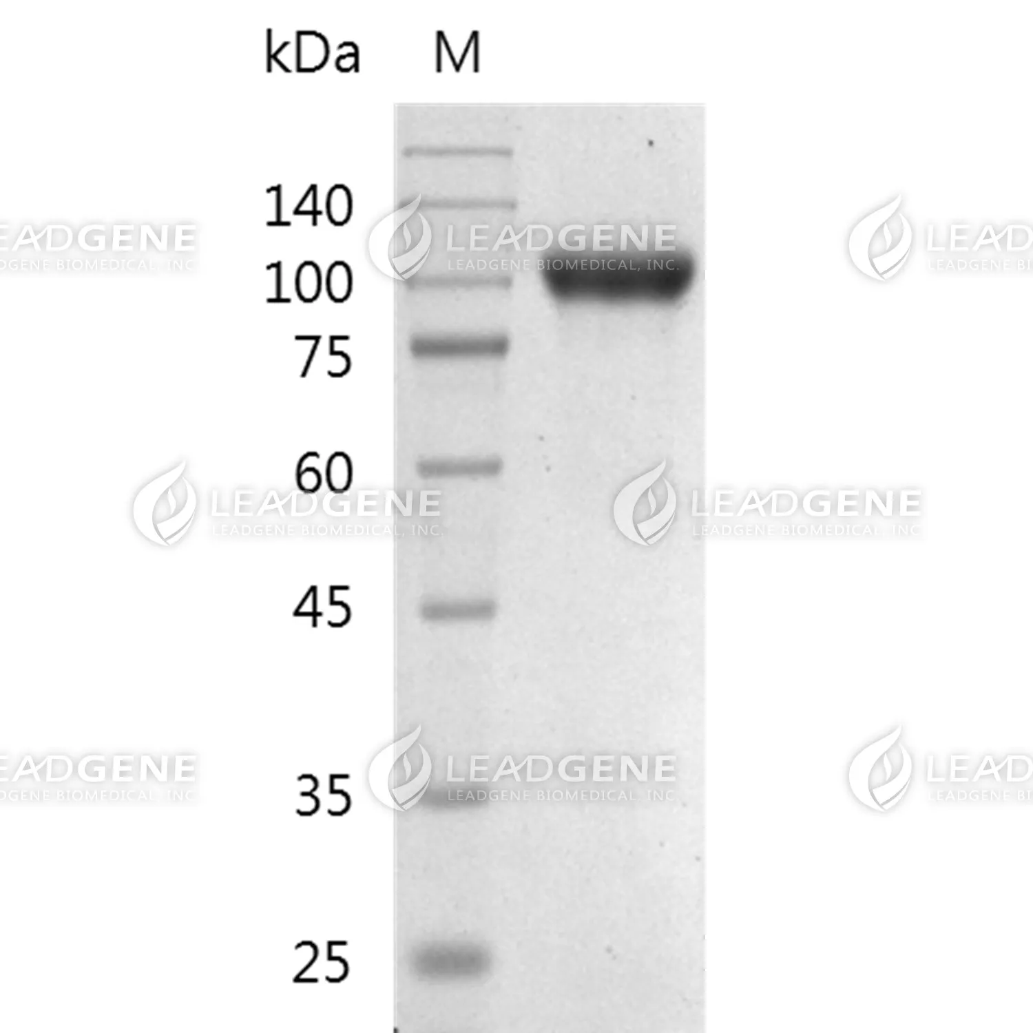 Human CD22, His Tag, HEK293