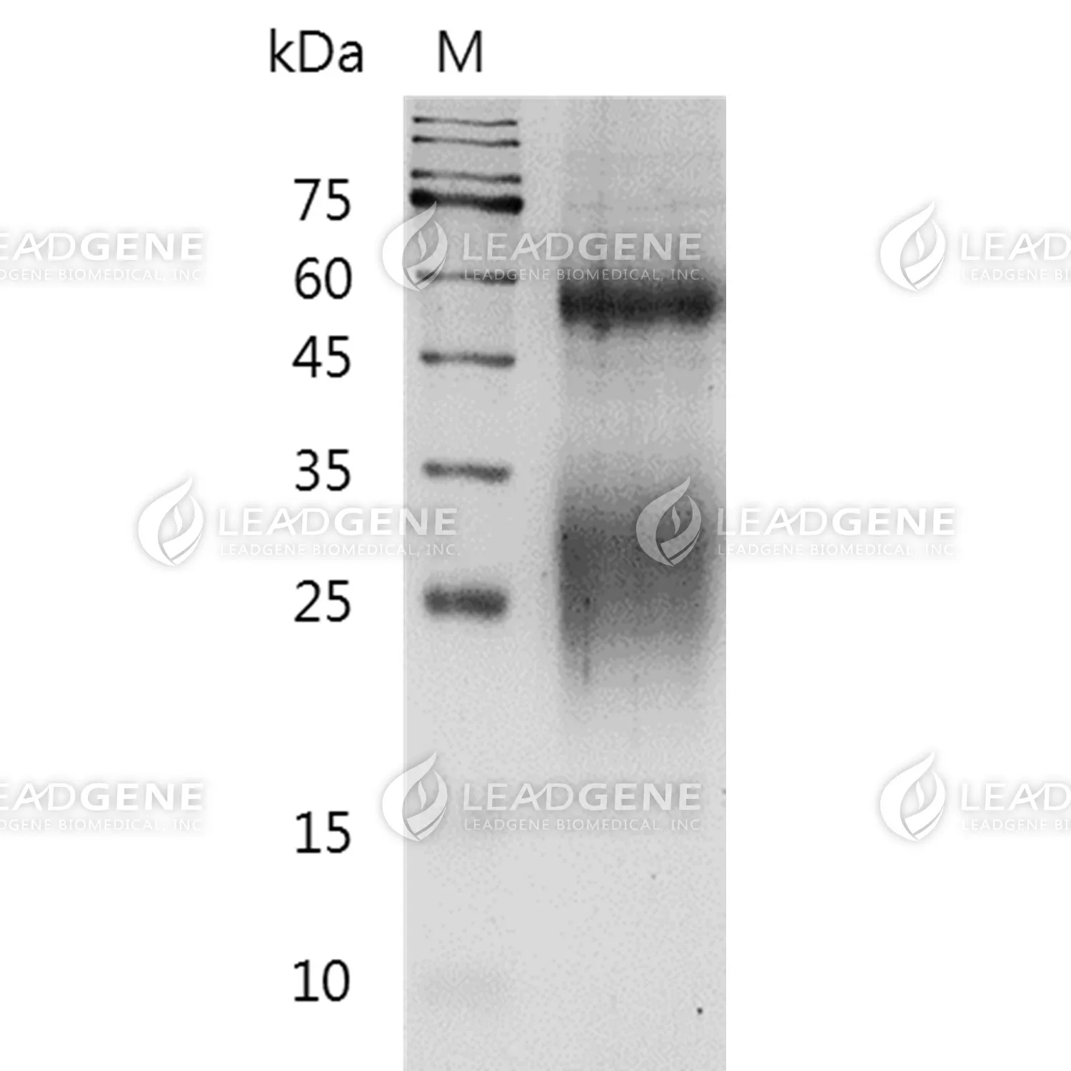 Human CD79 Beta, His Tag, HEK293