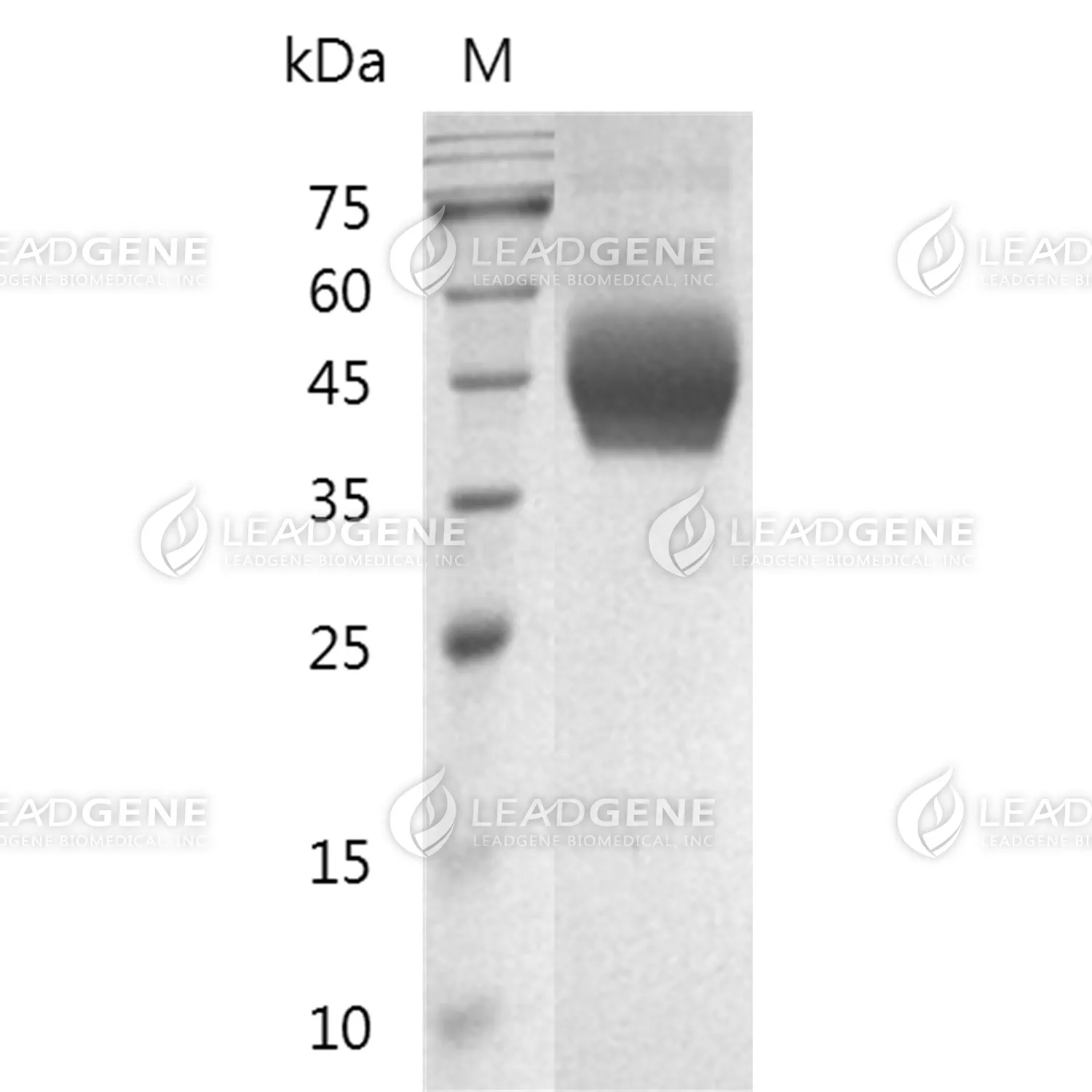 Human CD33, His Tag, HEK293