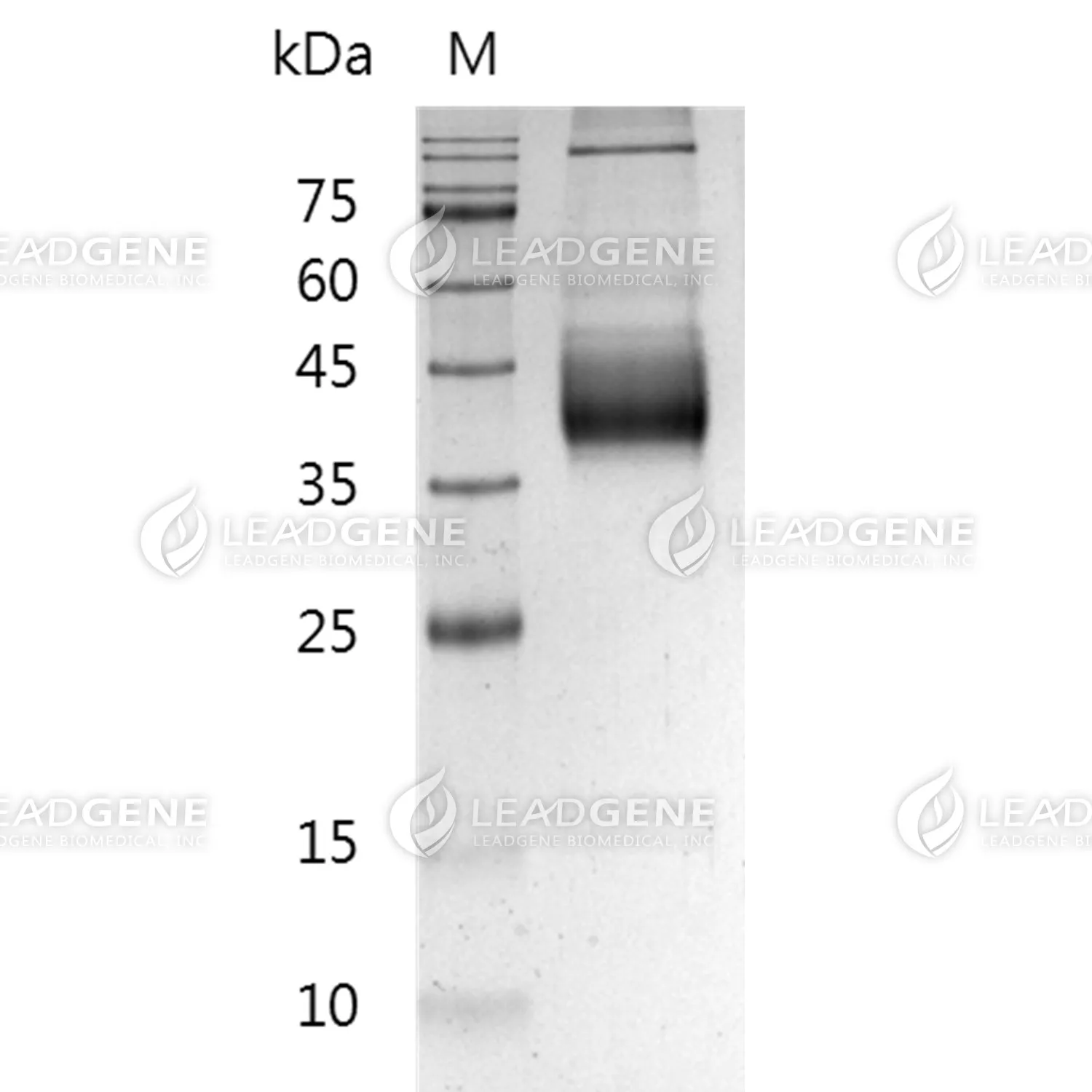 Human CD38, His Tag, CHO