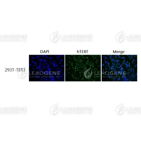 Anti-TERT Antibody [Clone 54-2]