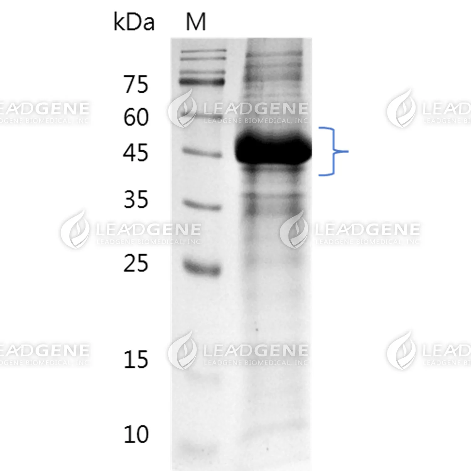 Human DLL3, His Tag, CHO