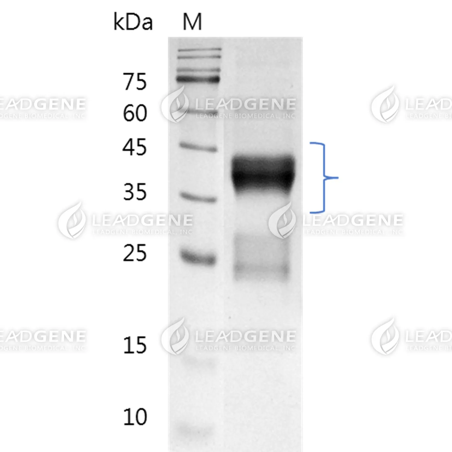 Human TNFR2, His Tag, CHO