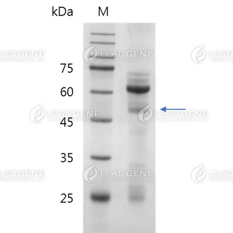 Human Lipoprotein a, (Lp(a)), Tag free