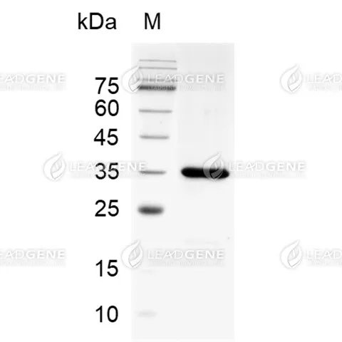 LeadGMP® Inorganic Pyrophosphatase, His Tag, E. coli