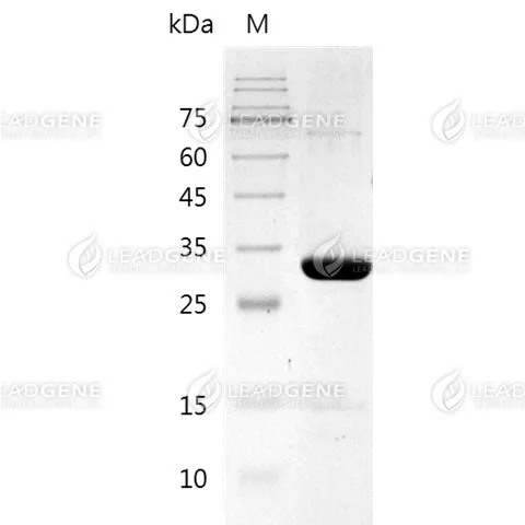 Human Metapneumovirus (MPV) Matrix Protein, His Tag, E. coli