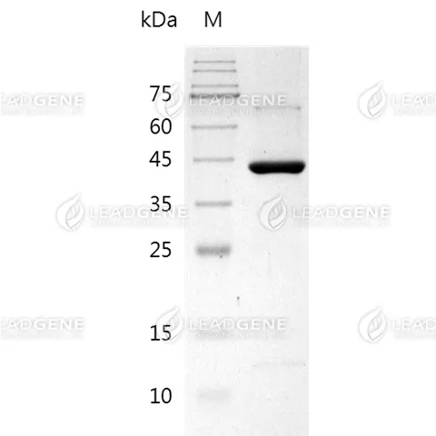 Human Metapneumovirus (MPV) Nucleocapsid Protein, His Tag, E. coli