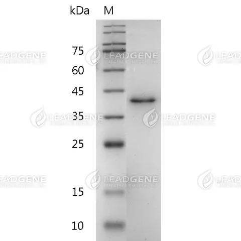 Human IL-12 (p40), His Tag, E. coli