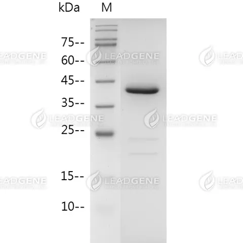 Human GIF, His Tag, E. coli